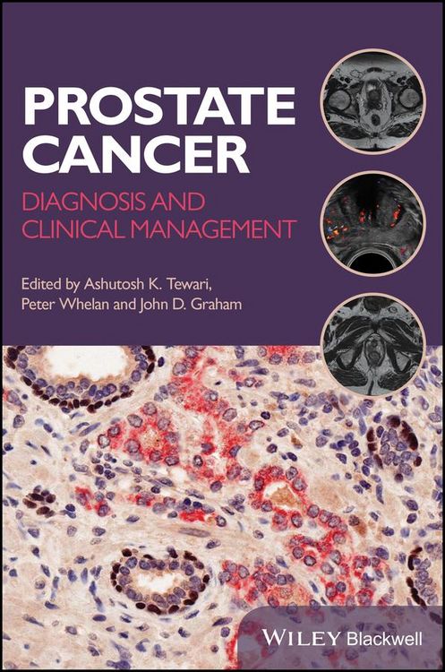 Produktbild: Prostate Cancer