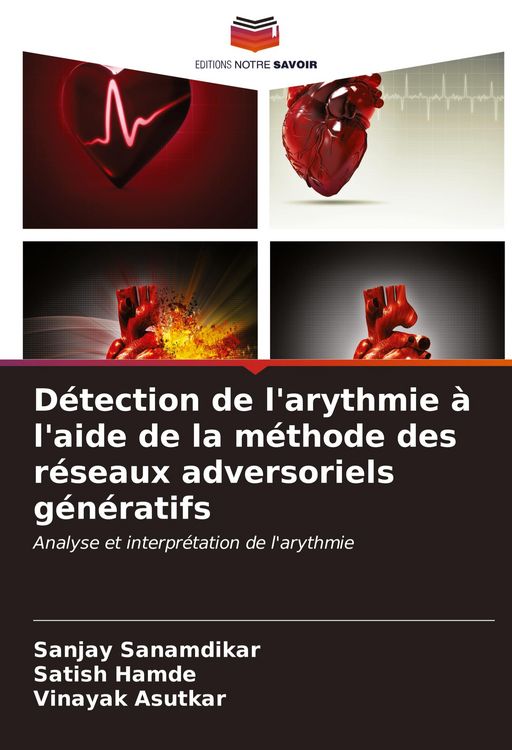 Produktbild: D&eacute;tection de l'arythmie &agrave; l'aide de la m&eacute;thode des r&eacute;seaux adversoriels g&eacute;n&eacute;ratifs
