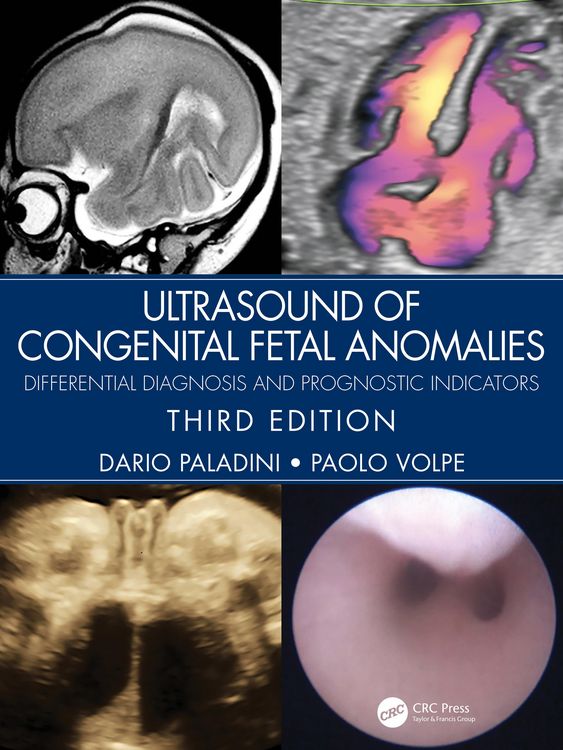 Produktbild: Ultrasound of Congenital Fetal Anomalies