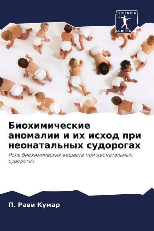 Produktbild: Biohimicheskie anomalii i ih ishod pri neonatal'nyh sudorogah