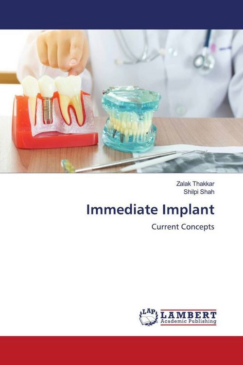 Produktbild: Immediate Implant