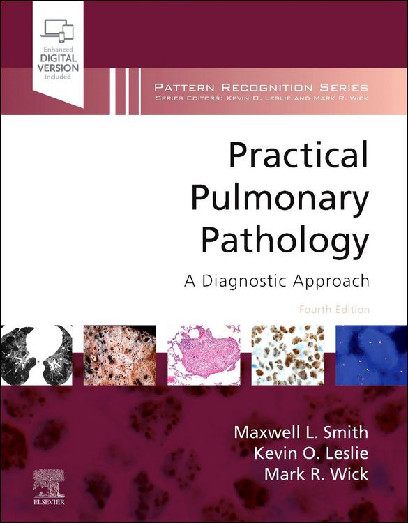 Produktbild: Practical Pulmonary Pathology