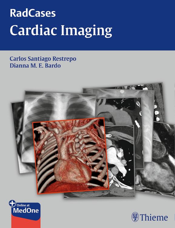 Produktbild: Radcases Cardiac Imaging