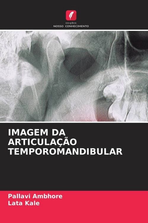 Produktbild: Imagem Da Articula&ccedil;&atilde;o Temporomandibular