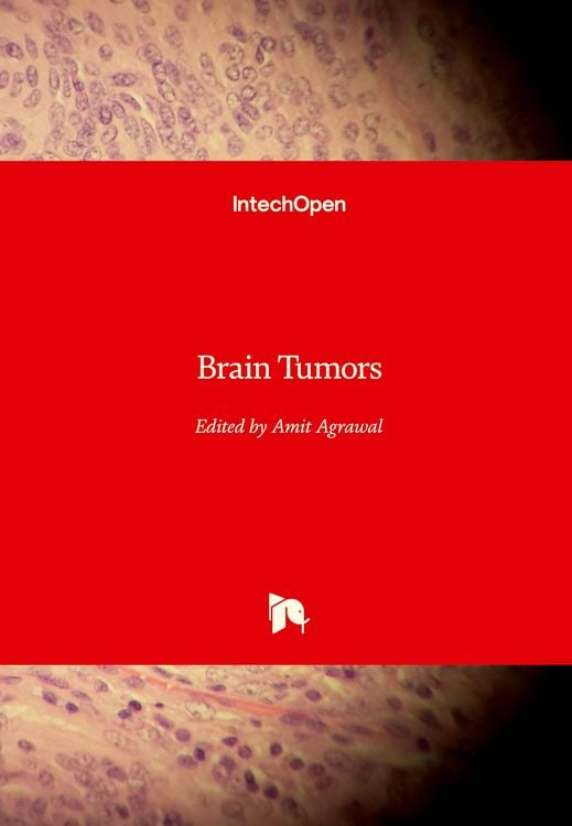 Produktbild: Brain Tumors