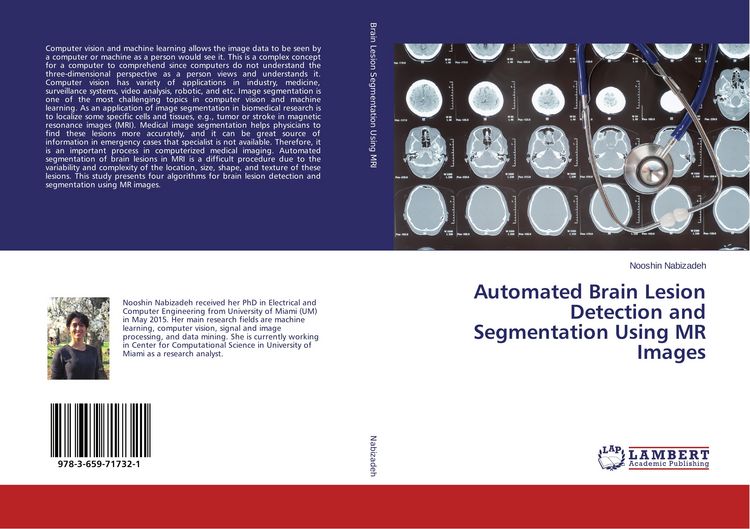 Produktbild: Automated Brain Lesion Detection and Segmentation Using MR Images