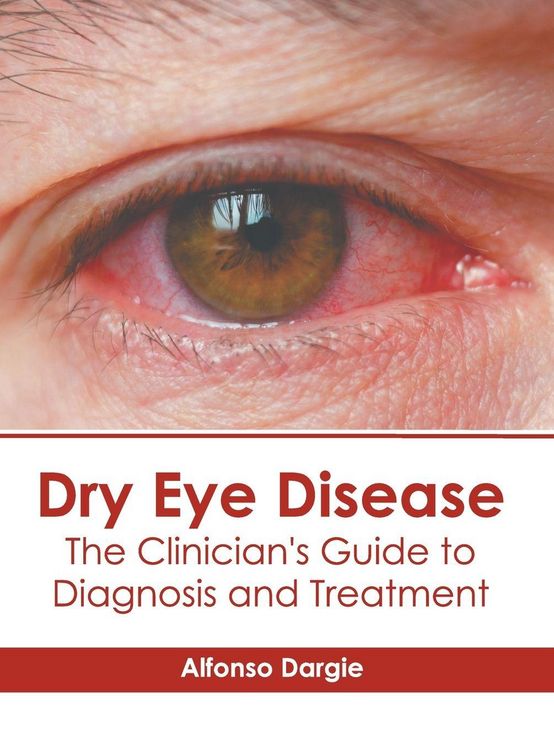 Produktbild: Dry Eye Disease: The Clinician's Guide to Diagnosis and Treatment