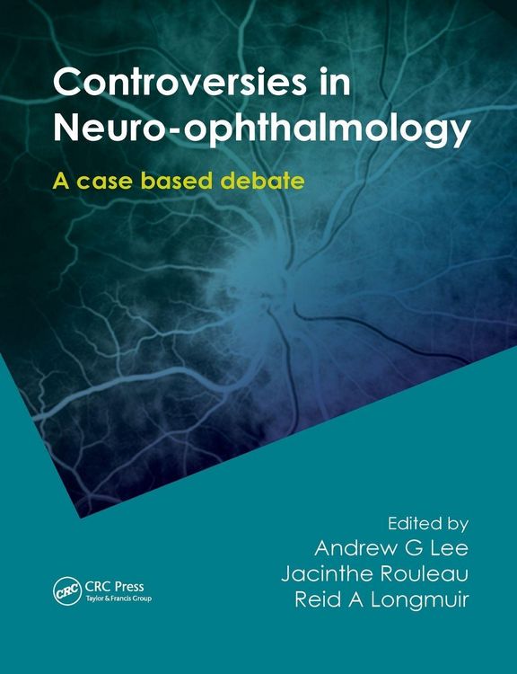 Produktbild: Controversies in Neuro-Ophthalmology