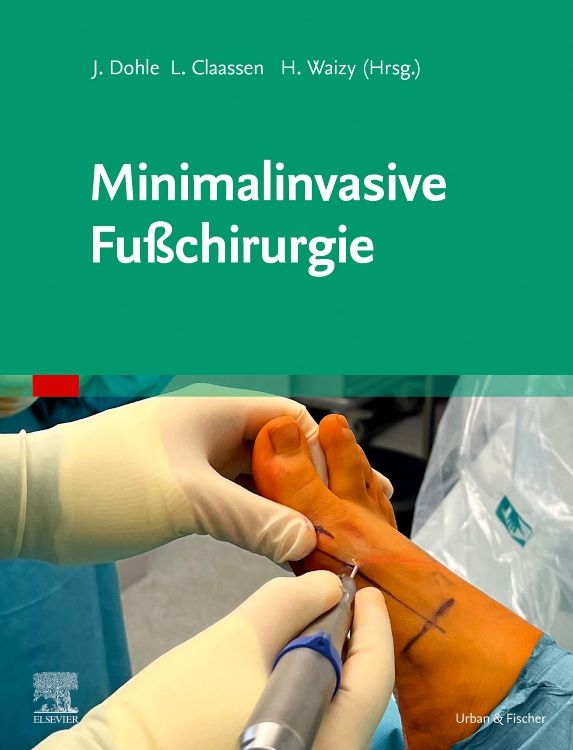 Produktbild: Minimalinvasive Fu&szlig;chirurgie