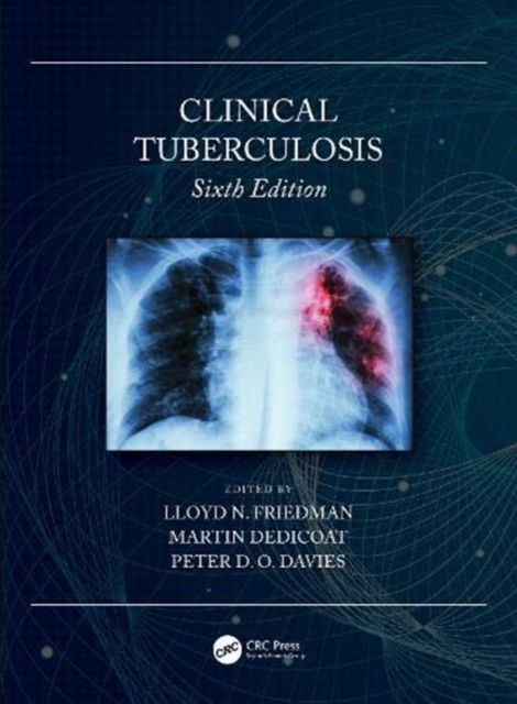 Produktbild: Clinical Tuberculosis 6/e