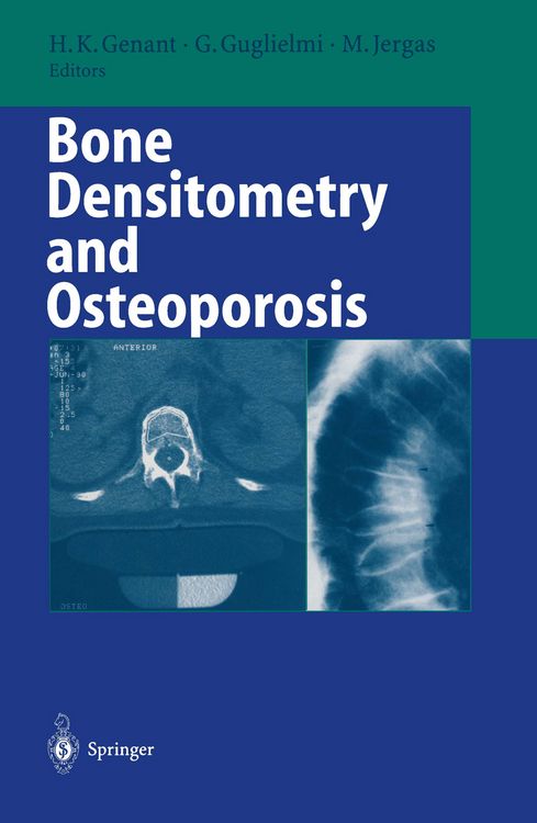 Produktbild: Bone Densitometry and Osteoporosis