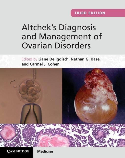 Produktbild: Altchek's Diagnosis and Management of Ovarian Disorders
