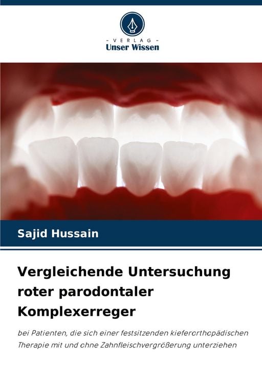 Produktbild: Vergleichende Untersuchung roter parodontaler Komplexerreger