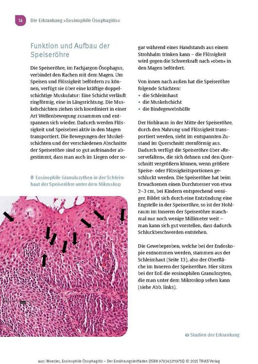 Produktbild: Eosinophile &Ouml;sophagitis - Der Ern&auml;hrungsleitfaden