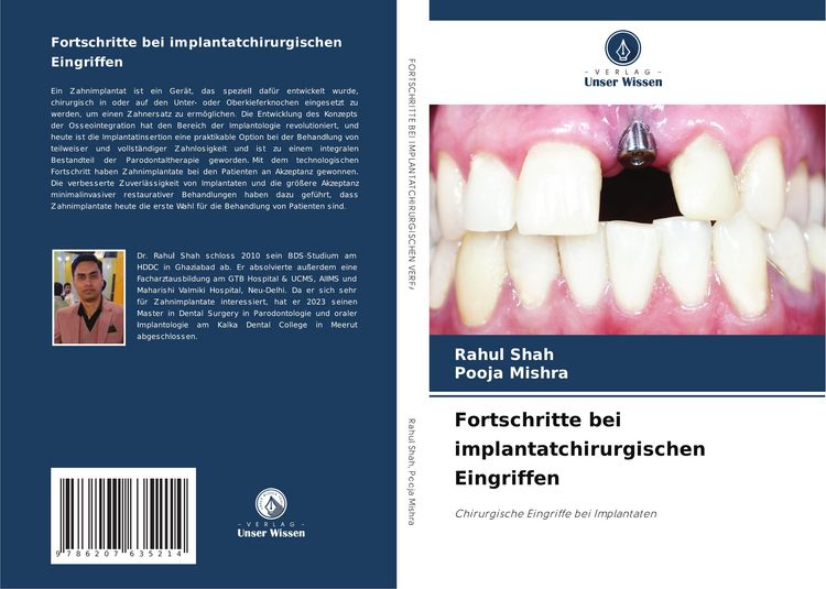 Produktbild: Fortschritte bei implantatchirurgischen Eingriffen