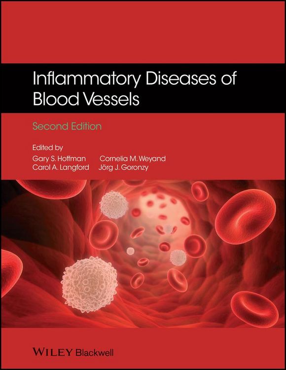 Produktbild: Inflammatory Diseases of Blood Vessels