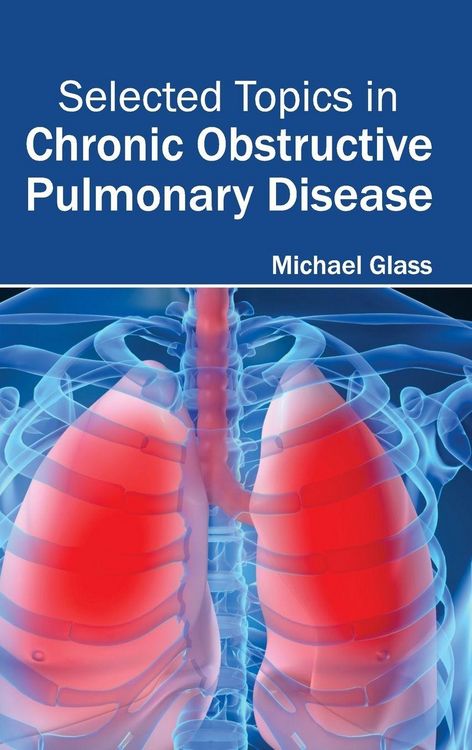 Produktbild: Selected Topics in Chronic Obstructive Pulmonary Disease