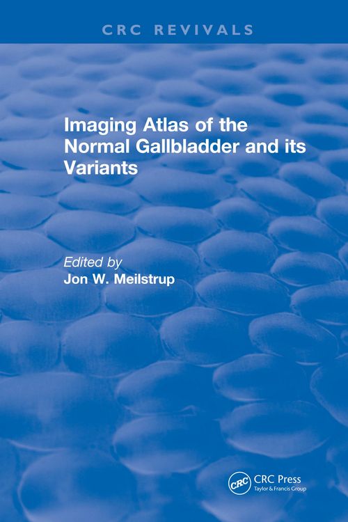 Produktbild: Imaging Atlas of the Normal Gallbladder and Its Variants