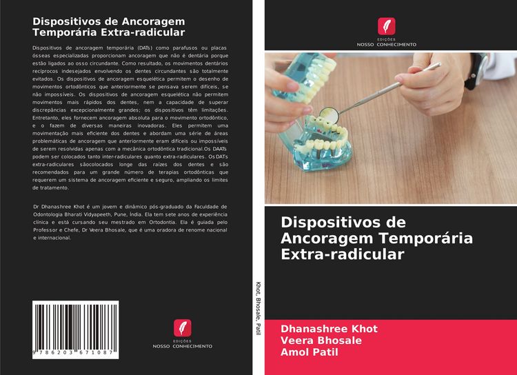 Produktbild: Dispositivos de Ancoragem Tempor&aacute;ria Extra-radicular