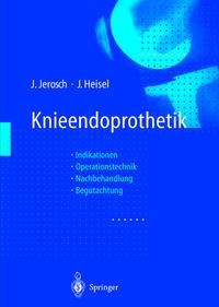 Produktbild: Knieendoprothetik