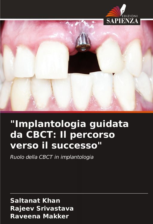 Produktbild: "Implantologia guidata da CBCT: Il percorso verso il successo"