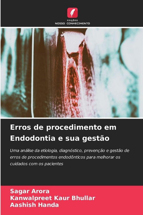 Produktbild: Erros de procedimento em Endodontia e sua gest&atilde;o