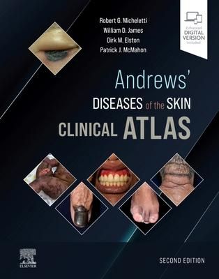 Produktbild: Andrews' Diseases of the Skin Clinical Atlas