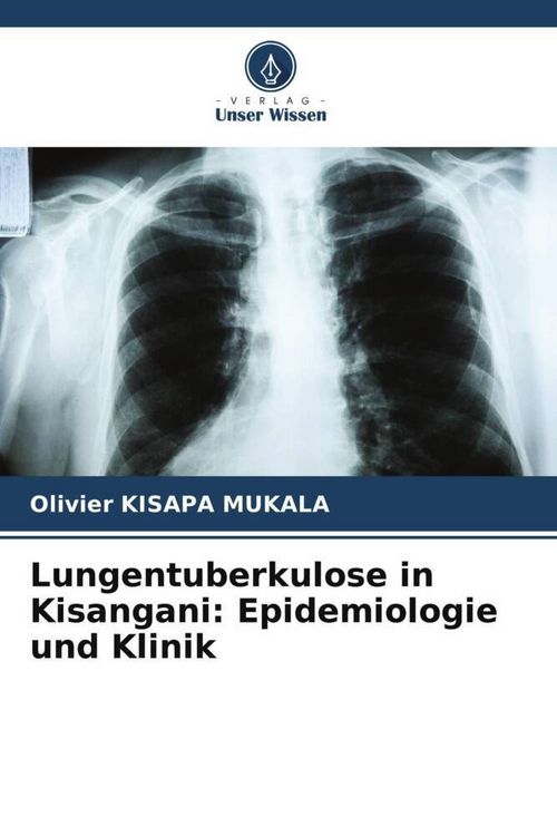 Produktbild: Lungentuberkulose in Kisangani: Epidemiologie und Klinik
