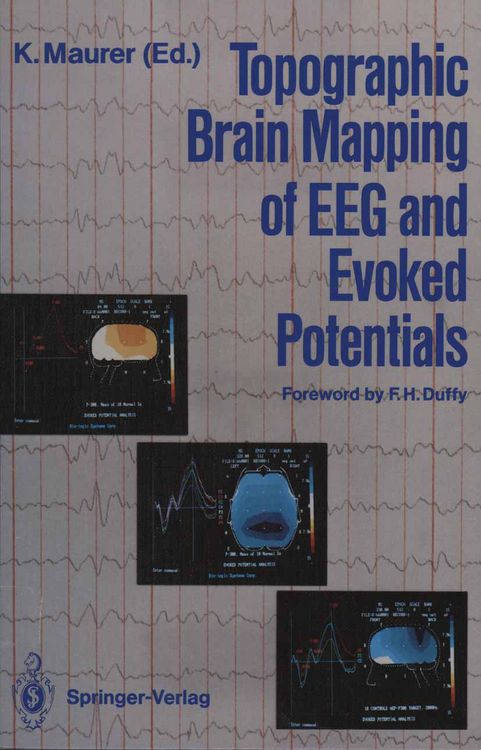Produktbild: Topographic Brain Mapping of EEG and Evoked Potentials