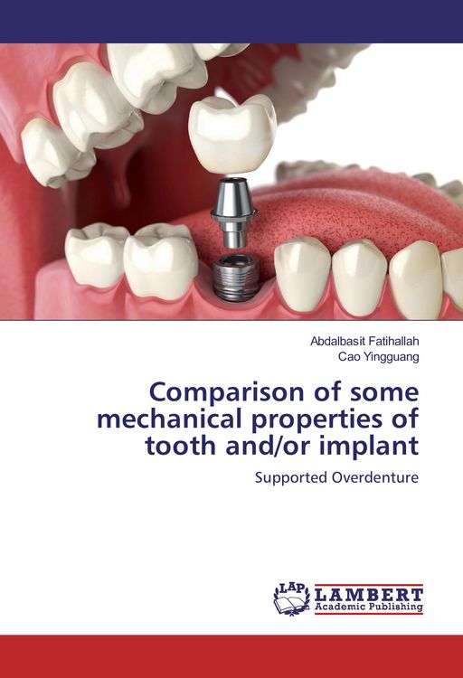 Produktbild: Comparison of some mechanical properties of tooth and/or implant