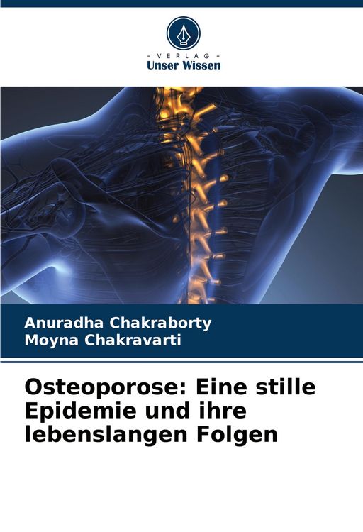 Produktbild: Osteoporose: Eine stille Epidemie und ihre lebenslangen Folgen