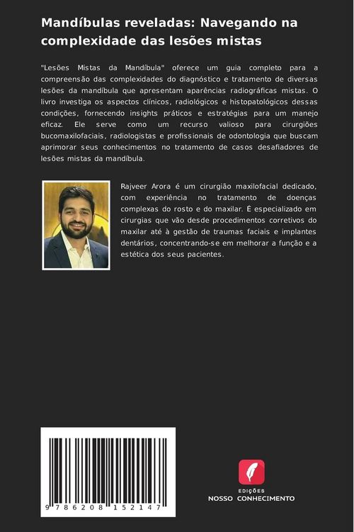 Produktbild: Mand&iacute;bulas reveladas: Navegando na complexidade das les&otilde;es mistas