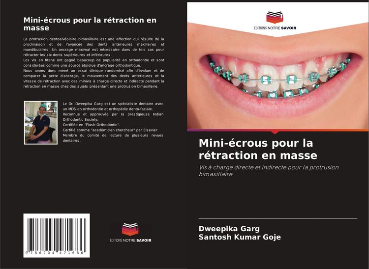 Produktbild: Mini-&eacute;crous pour la r&eacute;traction en masse