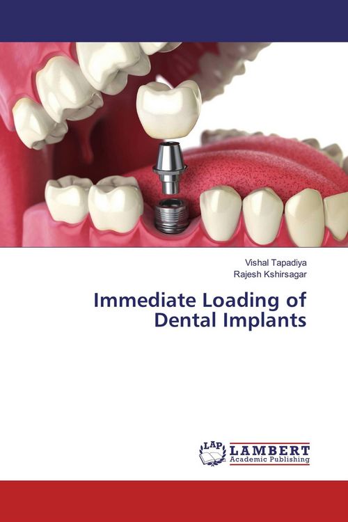 Produktbild: Immediate Loading of Dental Implants