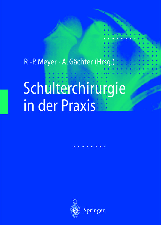 Produktbild: Schulterchirurgie in der Praxis