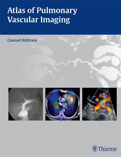 Produktbild: Atlas of Pulmonary Vascular Imaging