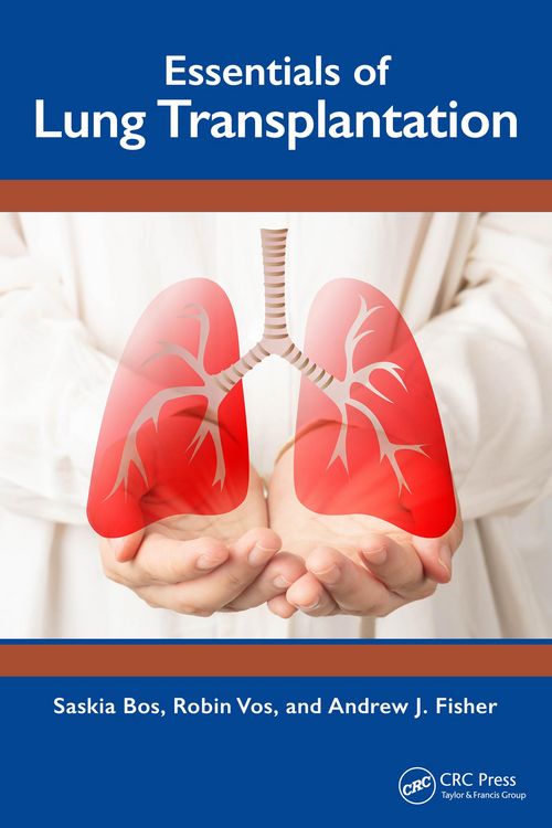 Produktbild: Essentials of Lung Transplantation