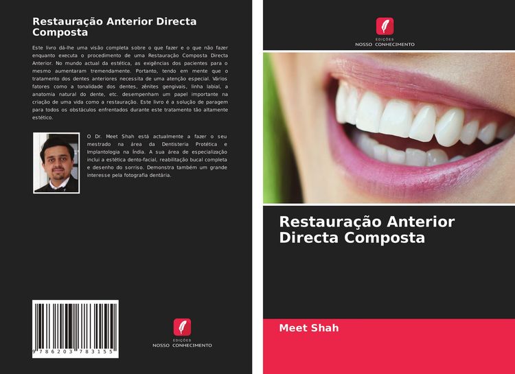 Produktbild: Restaura&ccedil;&atilde;o Anterior Directa Composta