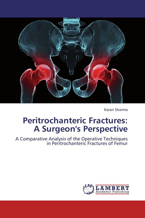Produktbild: Peritrochanteric Fractures: A Surgeon's Perspective