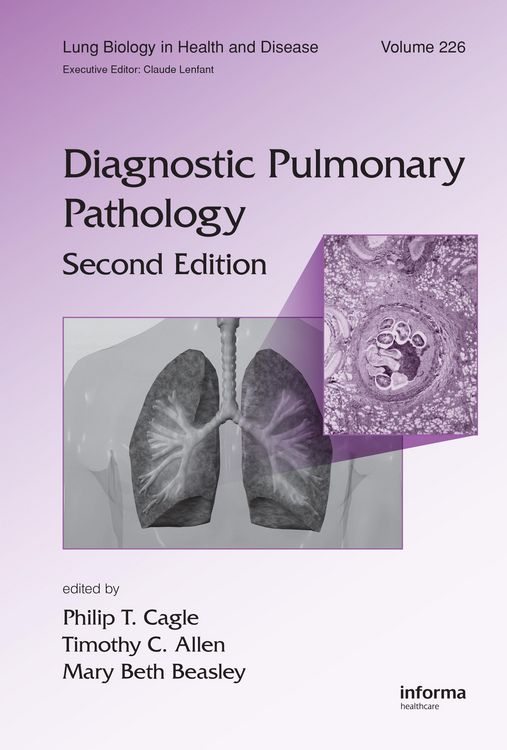 Produktbild: Diagnostic Pulmonary Pathology