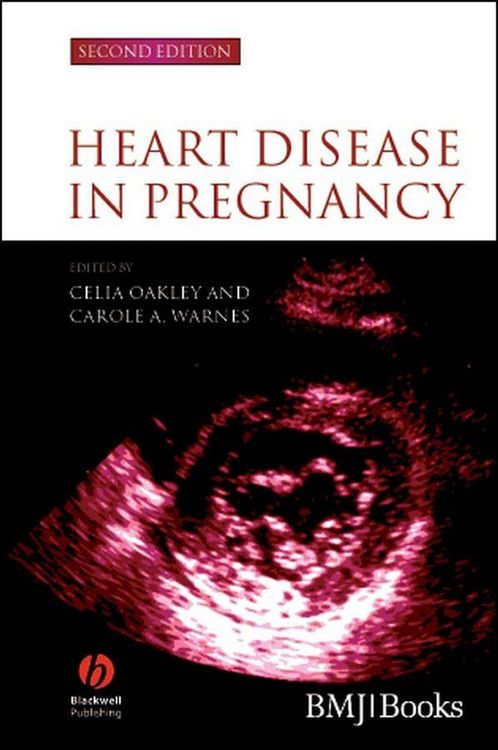 Produktbild: Heart Disease in Pregnancy