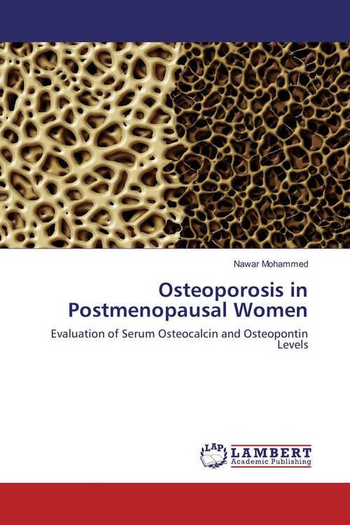 Produktbild: Osteoporosis in Postmenopausal Women
