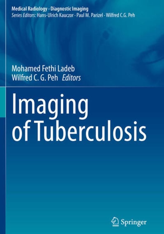 Produktbild: Imaging of Tuberculosis