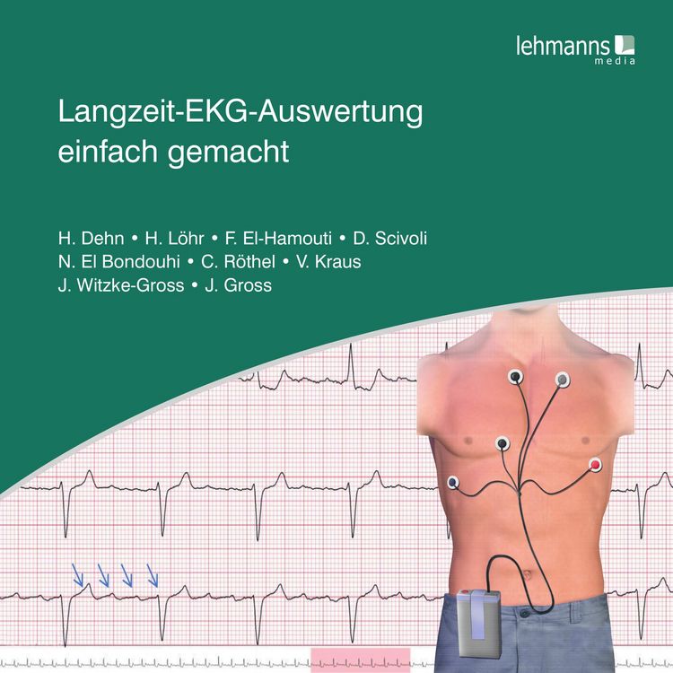 Produktbild: Langzeit-EKG-Auswertung einfach gemacht