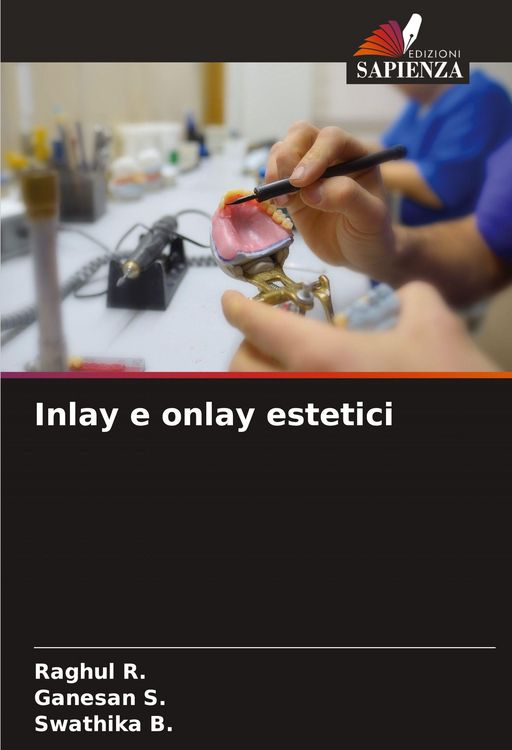 Produktbild: Inlay e onlay estetici