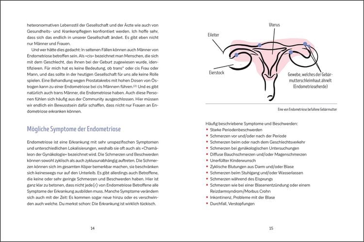 Produktbild: Leben mit Endometriose