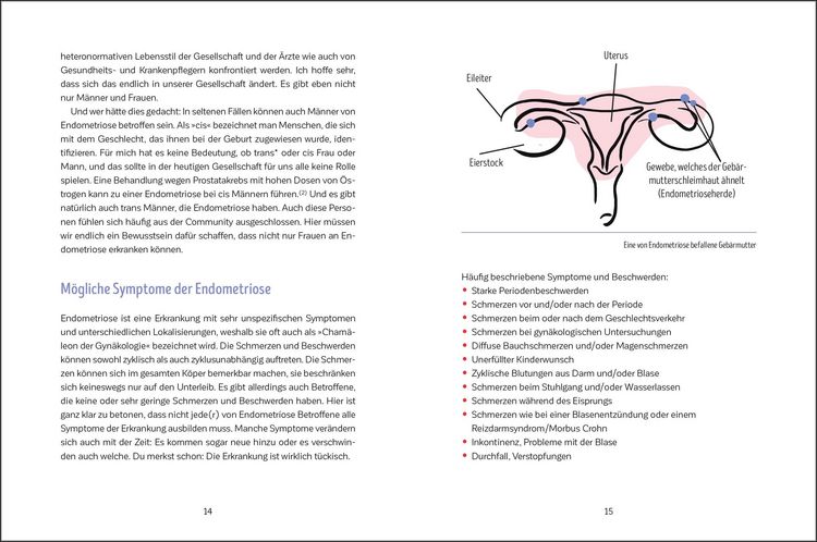 Produktbild: Leben mit Endometriose
