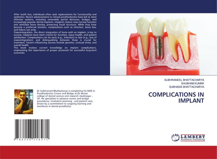 Produktbild: Complications in Implant