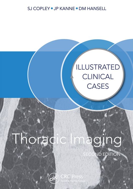 Produktbild: Thoracic Imaging