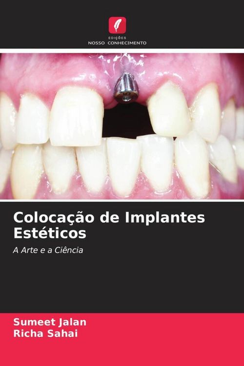 Produktbild: Coloca&ccedil;&atilde;o de Implantes Est&eacute;ticos